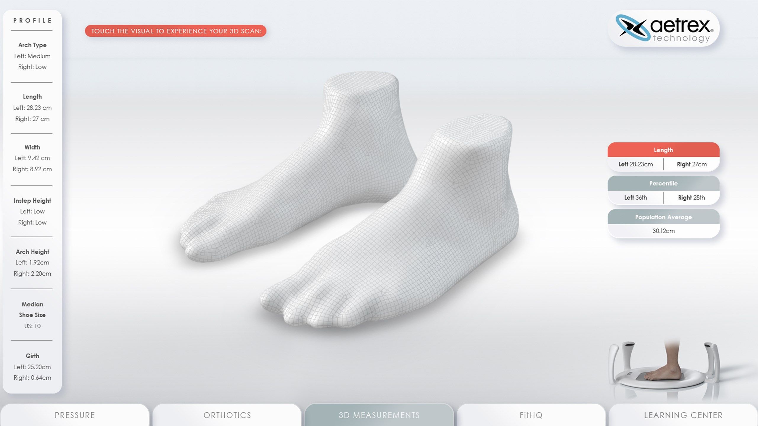 aetrex orthotics store locator